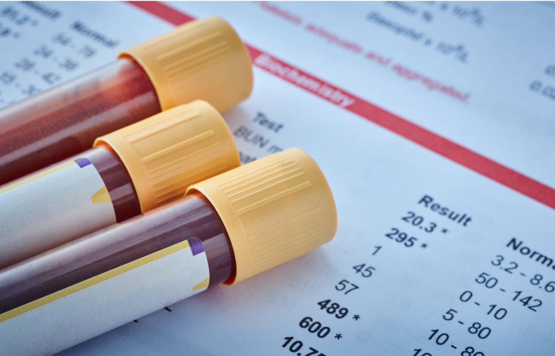 Blood monitoring with Athlete Blood Test ELEVATE Performance Services